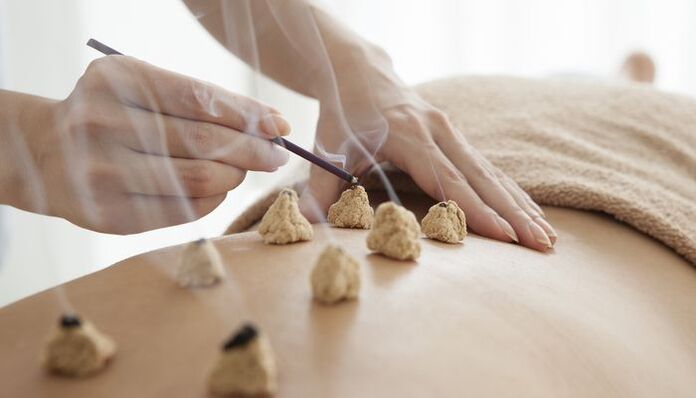 Quentando puntos bioactivos nas costas para a osteocondrose